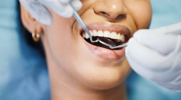 Best Emergency Root Canal Treatment in Oak Park, IL