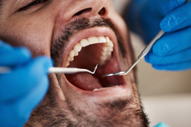 Best Emergency Dental Care for Broken or Chipped Teeth in Oak Park, IL