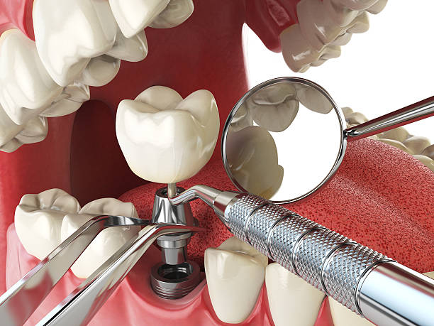 Best Emergency Gum Treatment in Oak Park, IL